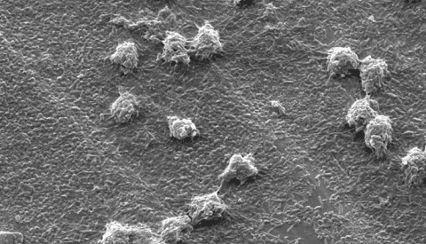 Gram Negative Bacteria