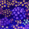 Zoanthids